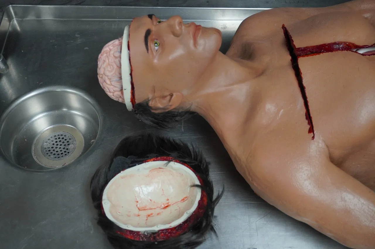 Autopsy David with Removable Skull Cap and Brain