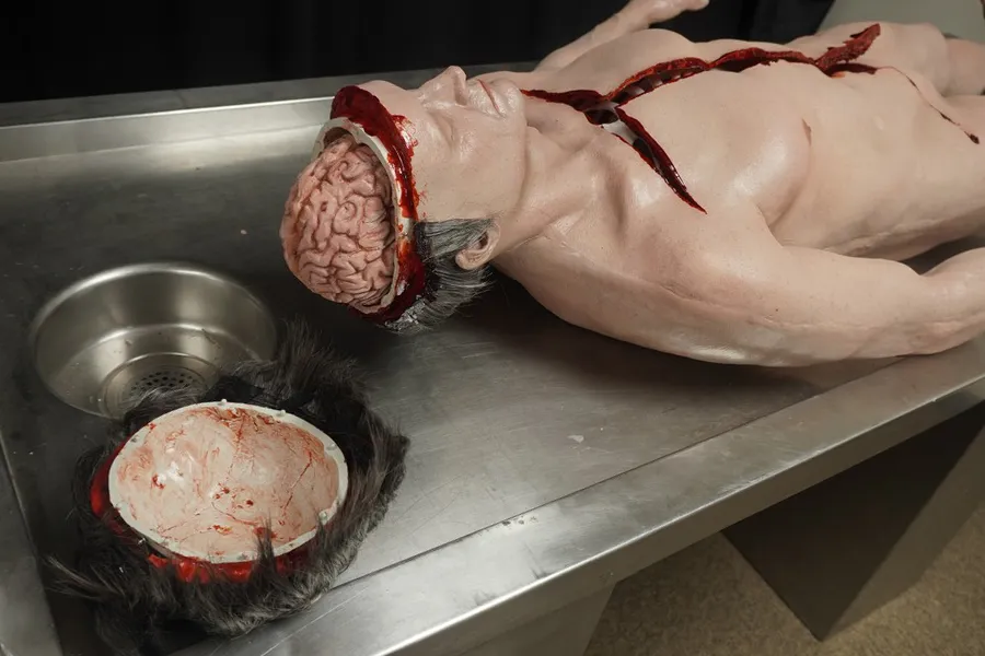 Autopsy Jack with Removable Skull Cap and Brain